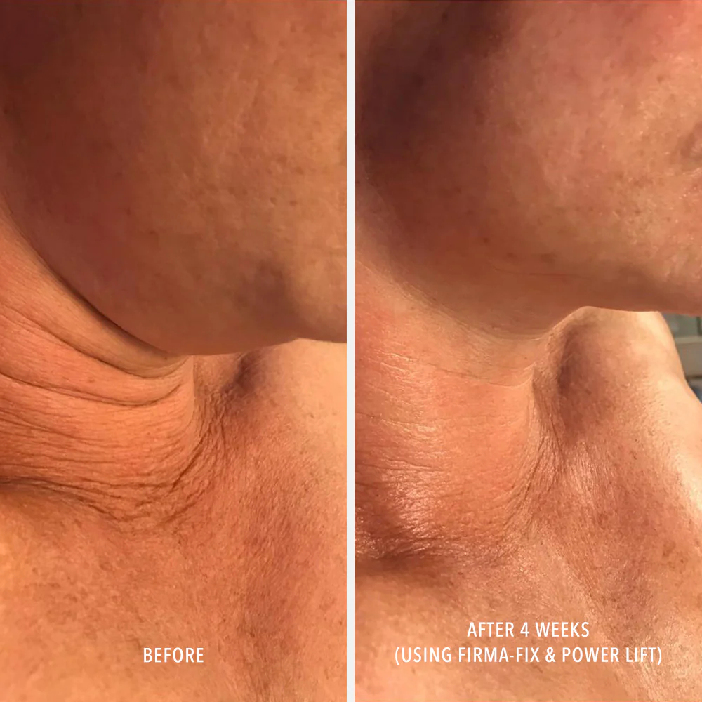Ліфтинг-сироватка для шиї та зони декольте HydroPeptide Firm-A-Fix Nectar